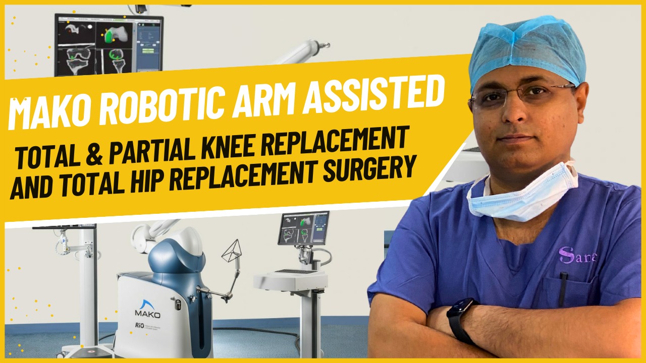 Robotic Hip and Knee Replacement