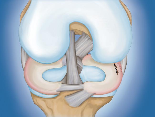 Anatomy